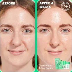 Revolution Skin Cloud Clear Niacinamide & IPC Clarifying Moisturiser 50ml